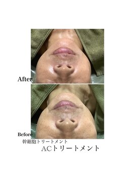 サザンベル 石垣店(SOUTHERN BELLE)/リアボーテ☆ACトリートメント