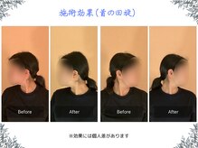 ボディ リセット アンド デザイン(Body Reset & Design)/【施術例】ビフォーアフター