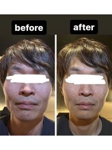 ミーナヴェル(Mi-Nabelle)/男性もたった数分でこの変化！