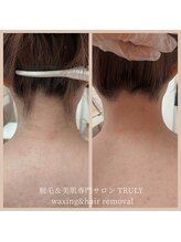 トゥルーリー(TRULY)/《うなじワックス》
