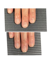 ウェルズユキ(well's yuki)/ハイポニキウムの育成