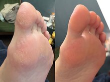 メグムサロン(Megumu Salon)/足つぼ/角質/マッサージ