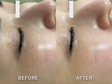 サロンドジェシカ(salon de Jessica)/プラズマ