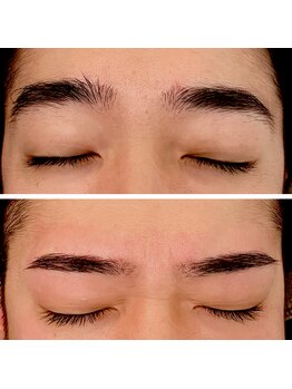 ジーニー(Genie)/髭脱毛のついでに眉毛脱毛