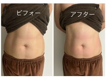 メディカルエステ ユウ(Yuu)の雰囲気（一回でこの効果！本気で痩せたい方痩身専門店にお任せ下さい☆）