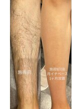 ムッシュ カナザワ(KANAZAWA)/あしもツルツル