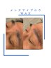 第一印象アップ！【メンズアイブロウWAX脱毛】3,980円