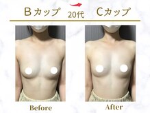 Ms.やまとなでしこ/ビフォーアフター