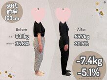 ひなた整骨院/ダイエット　箕面