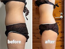 エミニーライフ(EMINY LIFE)/3ヶ月で7.5キロダイエットに成功