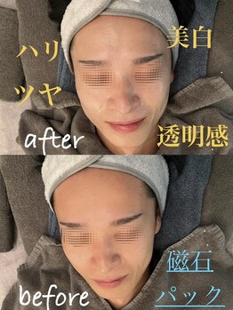 サリエ(S'allier)/美肌、美白、毛穴、磁石パック