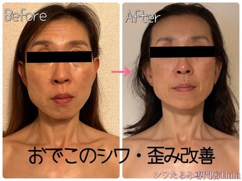 トルル(Tlulu)の写真/《押し寄せるシワに働きかけ、波をブロック!》やればやるほど巻き戻る肌年齢に脱帽&喜びが止まらない♪
