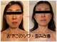 トルル(Tlulu)の写真/《押し寄せるシワに働きかけ、波をブロック!》やればやるほど巻き戻る肌年齢に脱帽&喜びが止まらない♪