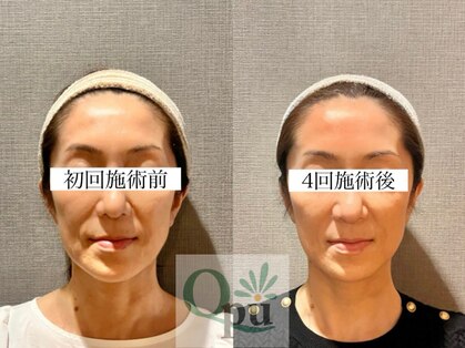 キュープ 表参道店(Qpu)の写真