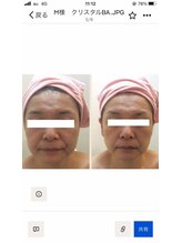 グリーンノート(GREEN NOTE)/ハ－ブピ－リング