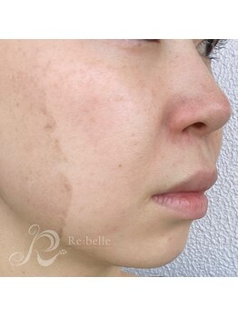 ベルメイク(BELLE MAKE)/リベル☆4日目