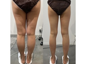 ミリュール(Millule)/個々に合わせた最適ケア