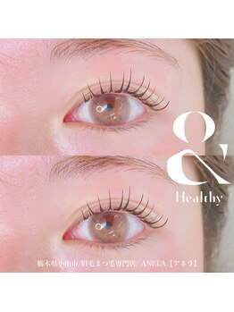 アネラ(ANELA)/LEDアンドヘルシー80【小山市】