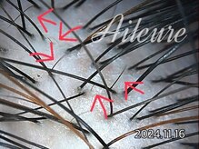 エルール トータルビューティ(Aileure total beauty)/育毛促進ケア