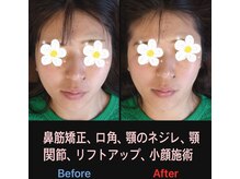 美容矯正サロン レレポノ(LELEPONO)/