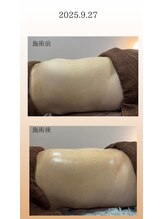 エスエー(SA)/腸内環境