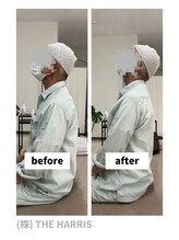 一関整体院/施術ビフォーアフター（首）