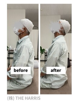 一関整体院/施術ビフォーアフター（首）