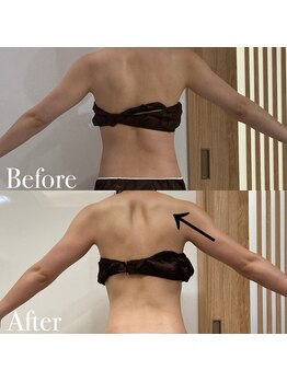 ボディヒーリングアンド小顔美容矯正 プララン/全身インドエステ☆