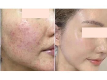 ラ メール(La mer)/★韓国肌★