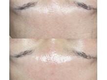 バーム(BAUM.)の雰囲気（vc12次世代ハーブピーリング登場★/ 毛穴洗浄/Wax同時施術可◎）