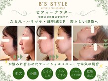 ビーズスタイル(B’S STYLE)