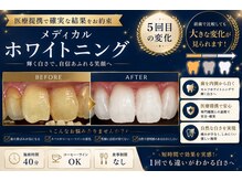ラキネイ 目黒(Lakinei)の雰囲気（医療提携で確実な結果へ！歯の黄ばみにセルフホワイトニング◎）