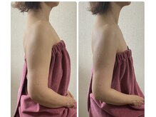 ブリランテ(Brillante)/体験のbeforeafter