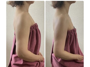 ブリランテ(Brillante)/体験のbeforeafter