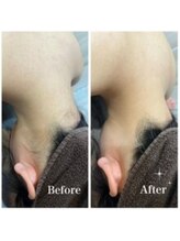 ファム(fam.)/うなじBefore,After