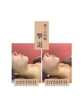 インディバケアプラチナム 横浜店/インディバ施術