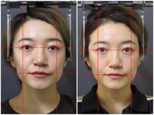 顔と身体の歪み矯正院 吉祥寺/ビフォーアフター