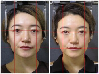 顔と身体の歪み矯正院 吉祥寺/ビフォーアフター