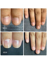 ルームイチマルイチネイルズ(Room101Nails.)/自爪育成・最強のネイルケア鳥取