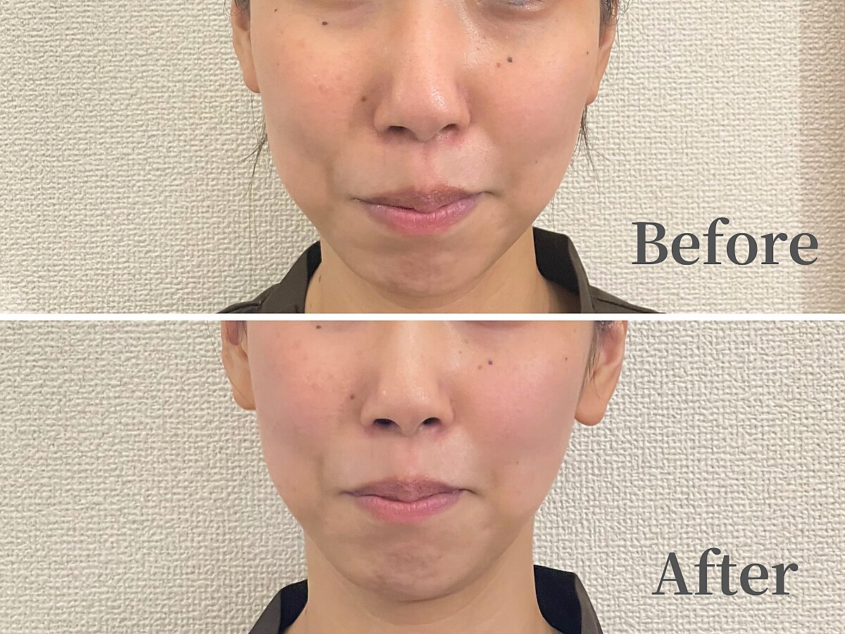 芝公園駅でコラーゲンマシンが人気のエステサロン｜ホットペッパー