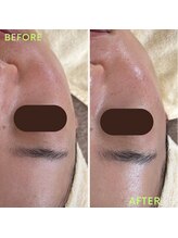 シュエット(CHOUETTE)/