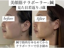 ユアン(YUAN)の雰囲気（鍼×美顔筋テラボーラー/たるみケア/小顔/シミケア/リフトアップ）