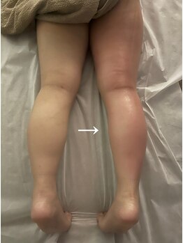 エニ 恵比寿(eni)/脚のビフォーアフター
