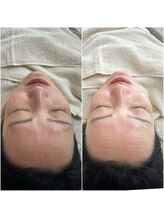 マヴィ 守口店(MavY.)/透明感とツヤ肌