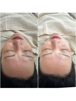 マヴィ 守口店(MavY.)/透明感とツヤ肌