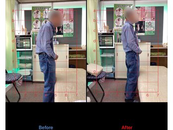 高芝鍼灸整骨院/猫背矯正