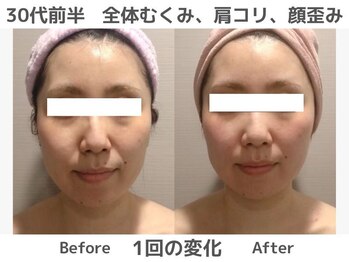 マテリアル(MATERIAL)/身体整うと顔が小さくなる！