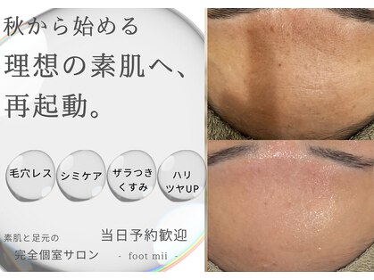 フットミー(foot mii)の写真