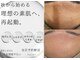 フットミー(foot mii)の写真
