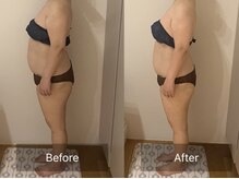 ヨサパーク こらっしぇ御徒町店(YOSA PARK)/お腹周りを得意とする施術